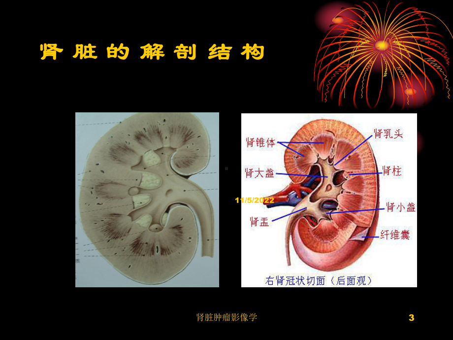 肾脏肿瘤影像学培训课件.ppt_第3页