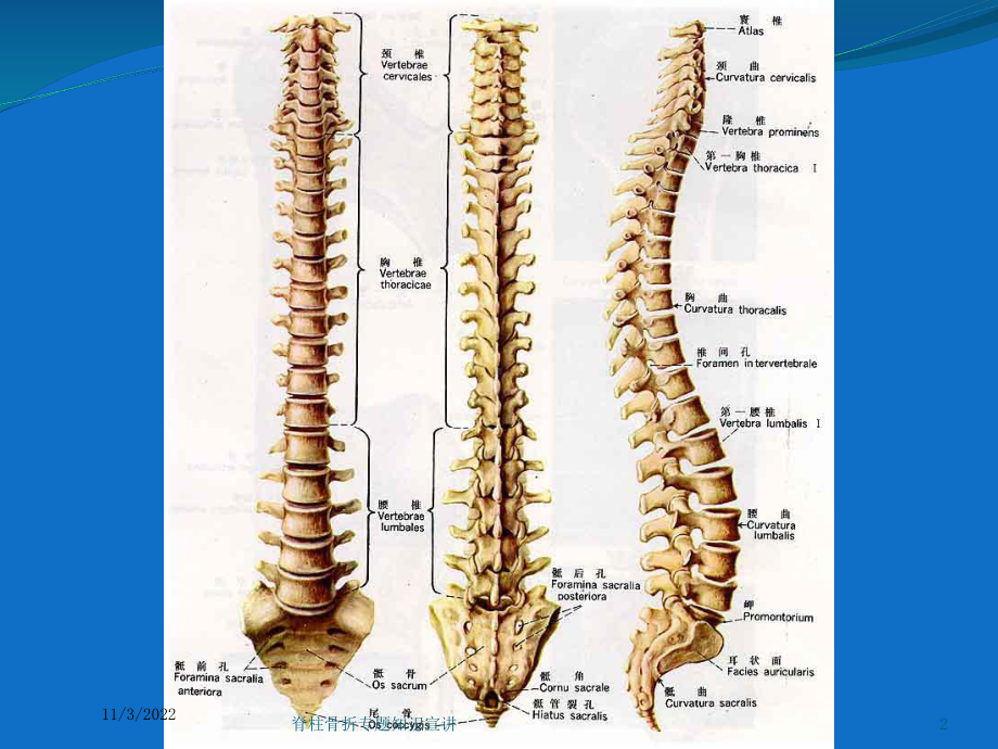 脊柱骨折专题知识宣讲培训课件.ppt_第2页