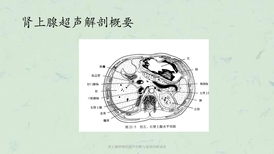 肾上腺肿瘤的超声诊断与鉴别诊断试讲课件.ppt_第3页