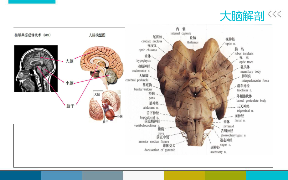 脑外伤患者护理查房课件2.ppt_第3页