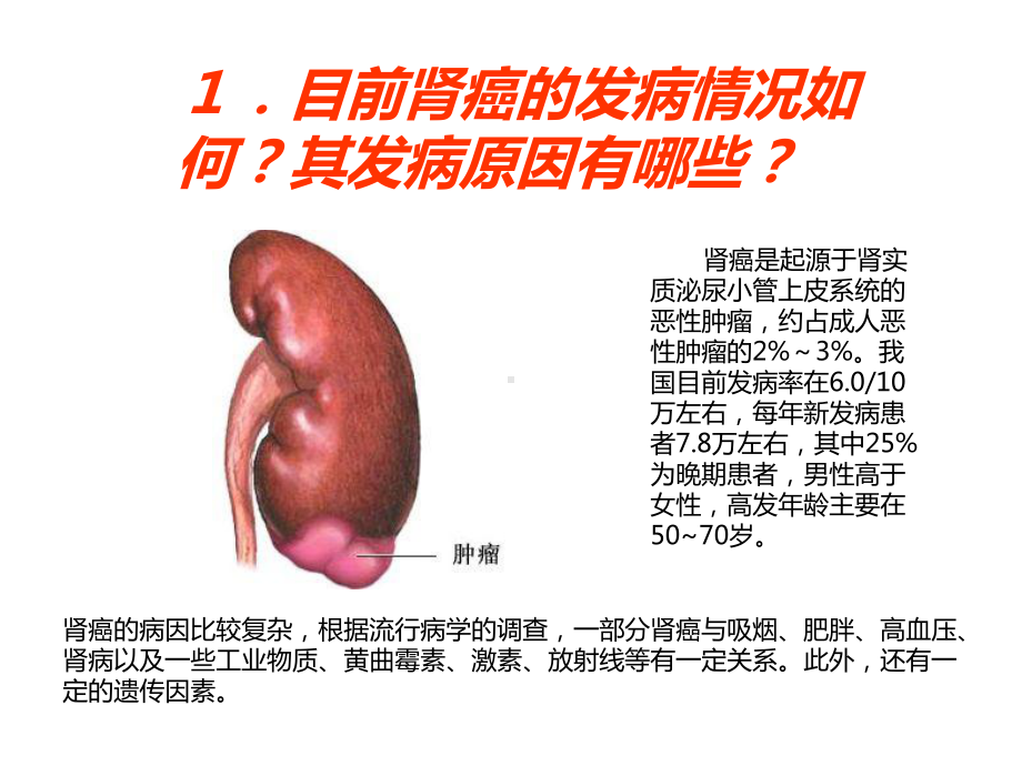 权威专家详细解读肾癌的7个知识课件.ppt_第3页