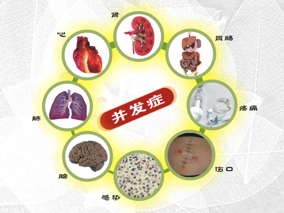 液体治疗-于湘友-课件1.ppt_第3页