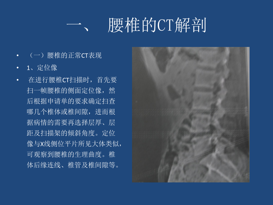 腰椎退行性变C诊断课件.pptx_第2页