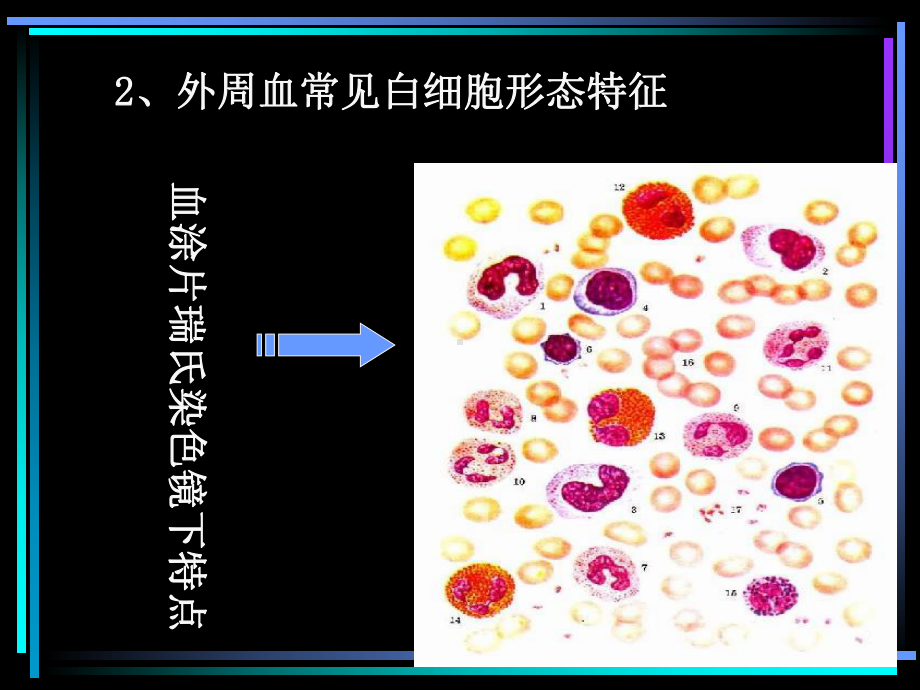 血液白细胞检验的形态特点课件.ppt_第2页