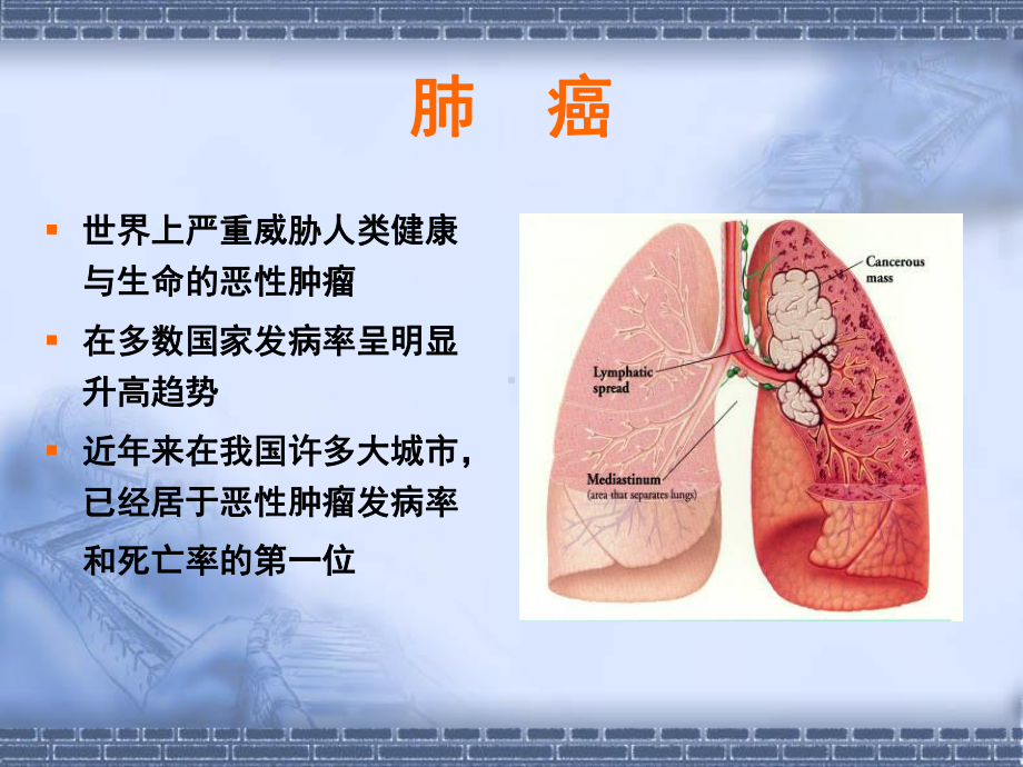 非小细胞肺癌的规范化治疗及进展S讲解课件.ppt_第2页