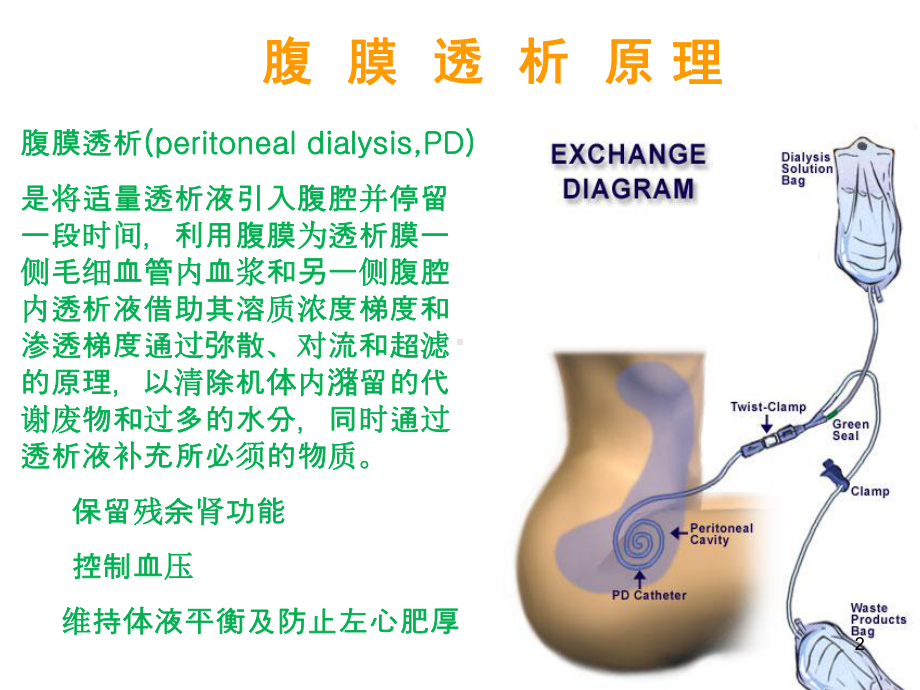 腹膜透析基本操作技术1优质课件.ppt_第2页