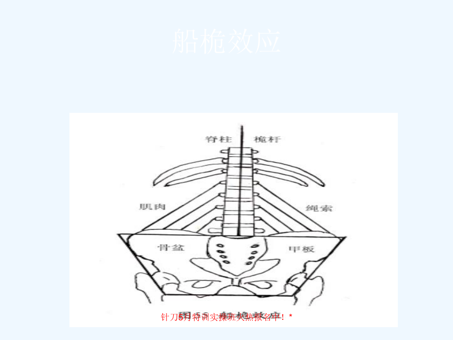 针刀手法治疗脊柱侧弯课件.ppt_第3页