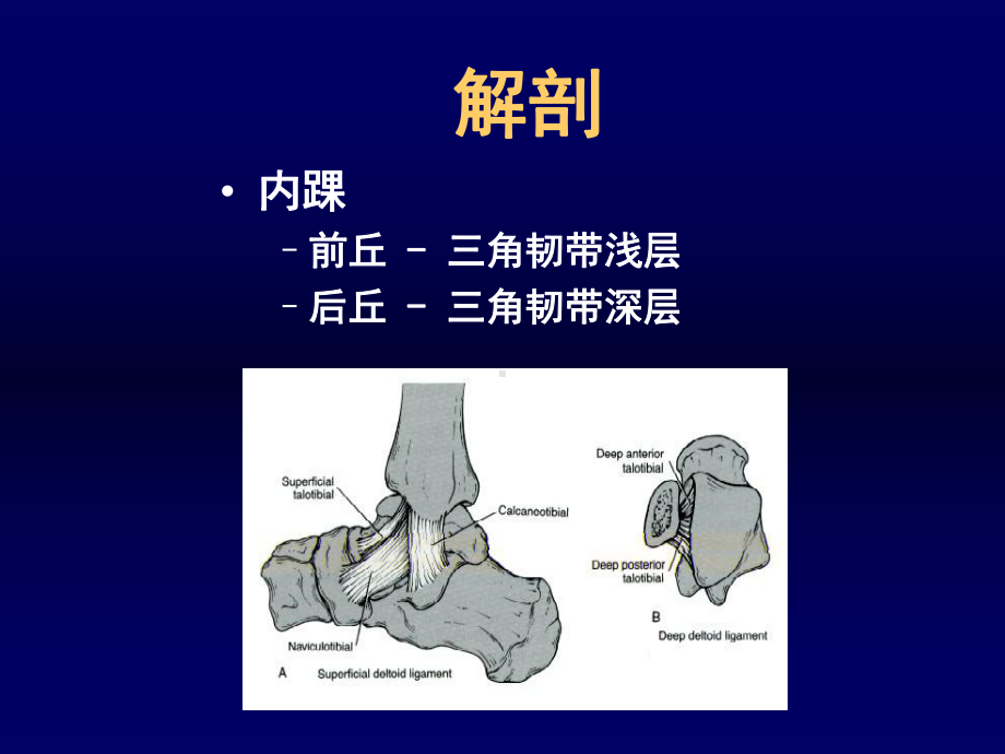 踝关节骨折的治疗模板课件.ppt_第3页