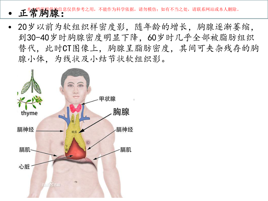 胸腺瘤的CT诊断培训课件.ppt_第3页