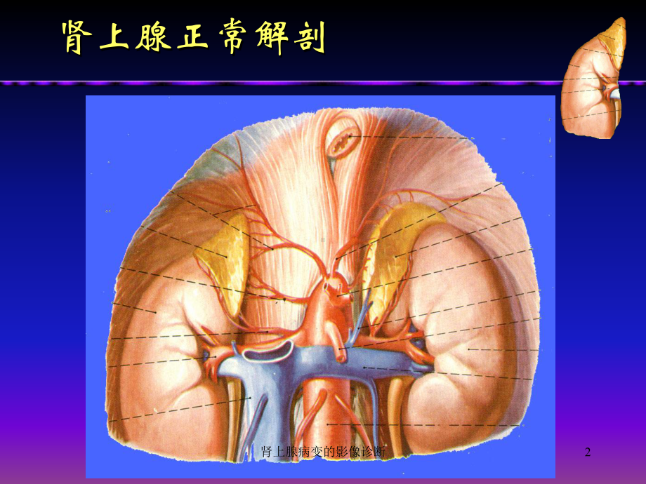 肾上腺病变的影像诊断课件.ppt_第2页