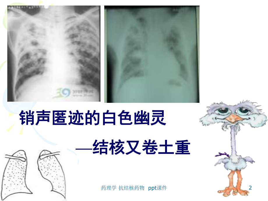 药理学-抗结核药物-课件.ppt_第2页