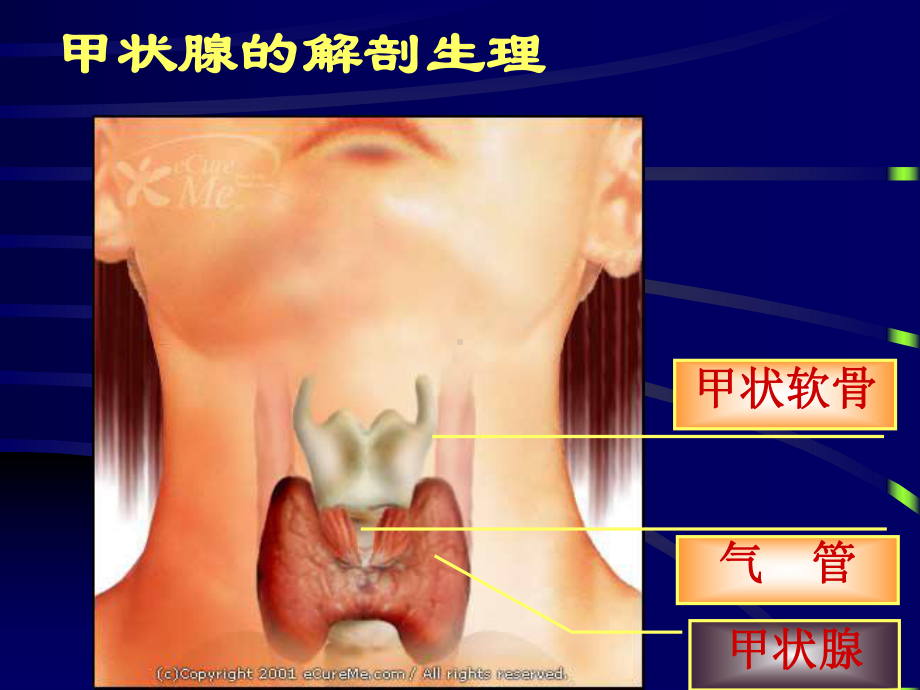 甲状腺疾病的护理课件.ppt_第3页