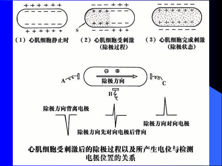 诊疗教学心电图的基本知识培训课件.ppt_第3页