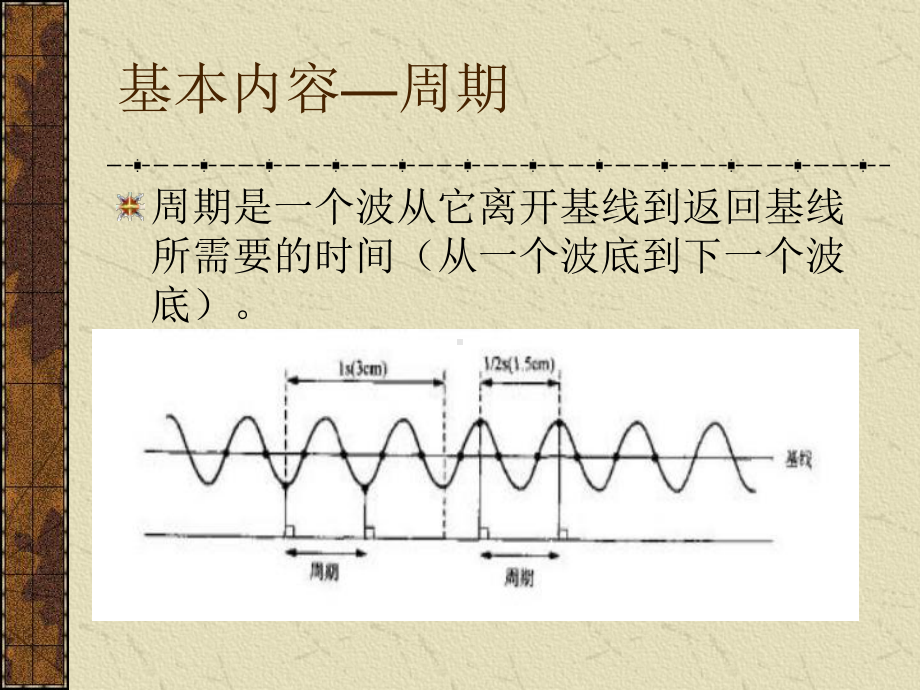 脑电图的临床应用课件.ppt_第3页