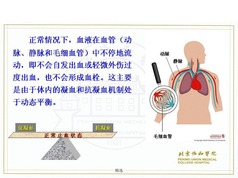 血友病病人的护理课件-2.ppt_第3页