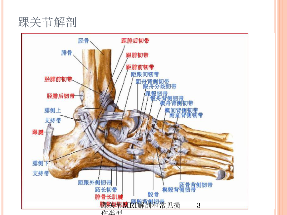 踝关节MRI解剖和常见损伤类型培训课件.ppt_第3页