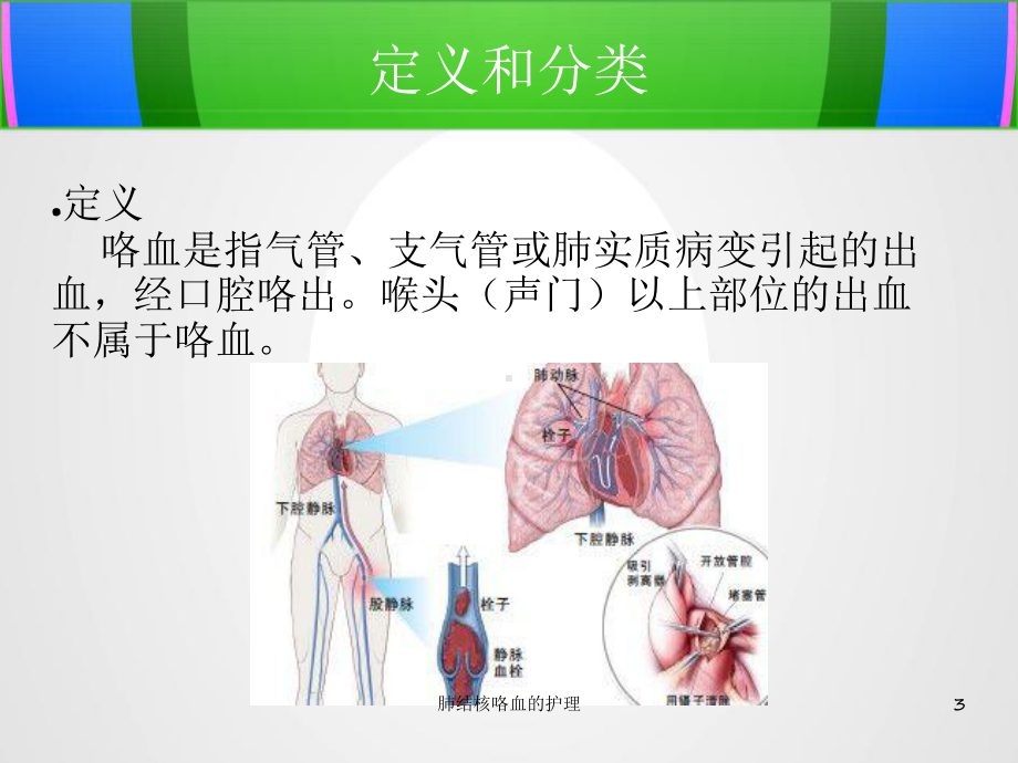 肺结核咯血的护理课件.ppt_第3页