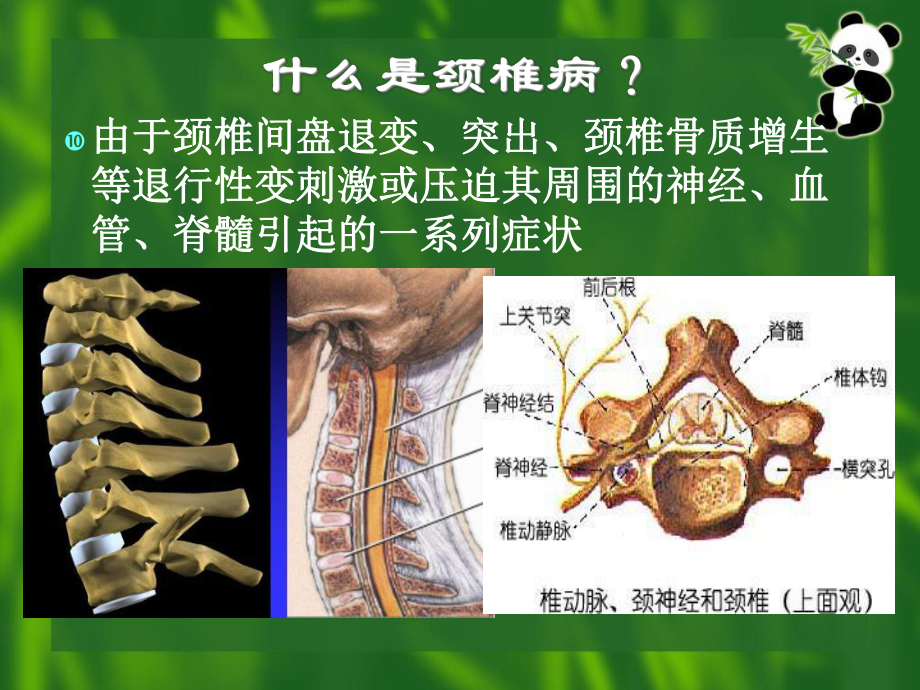 康复医学--颈椎病康复课件.ppt_第3页