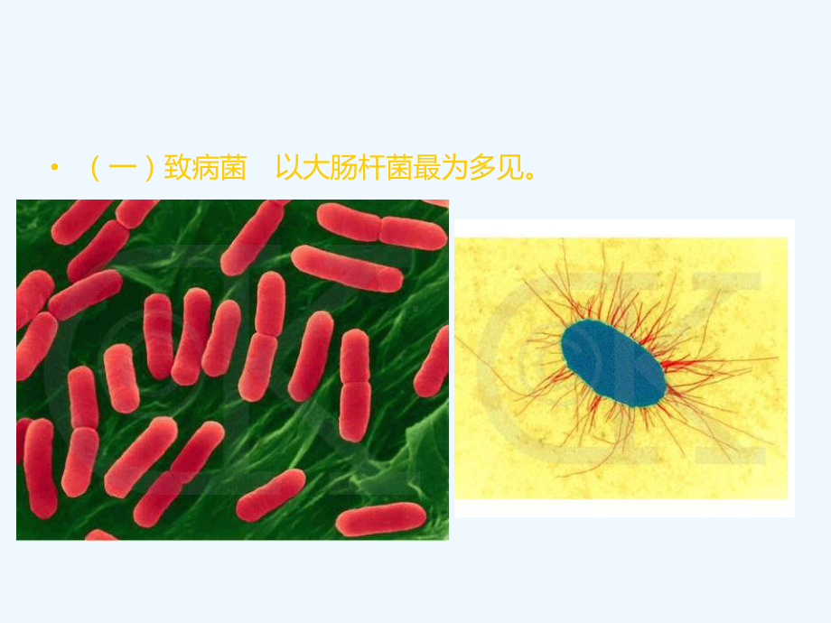 肾盂肾炎病人的护理课件.ppt_第2页