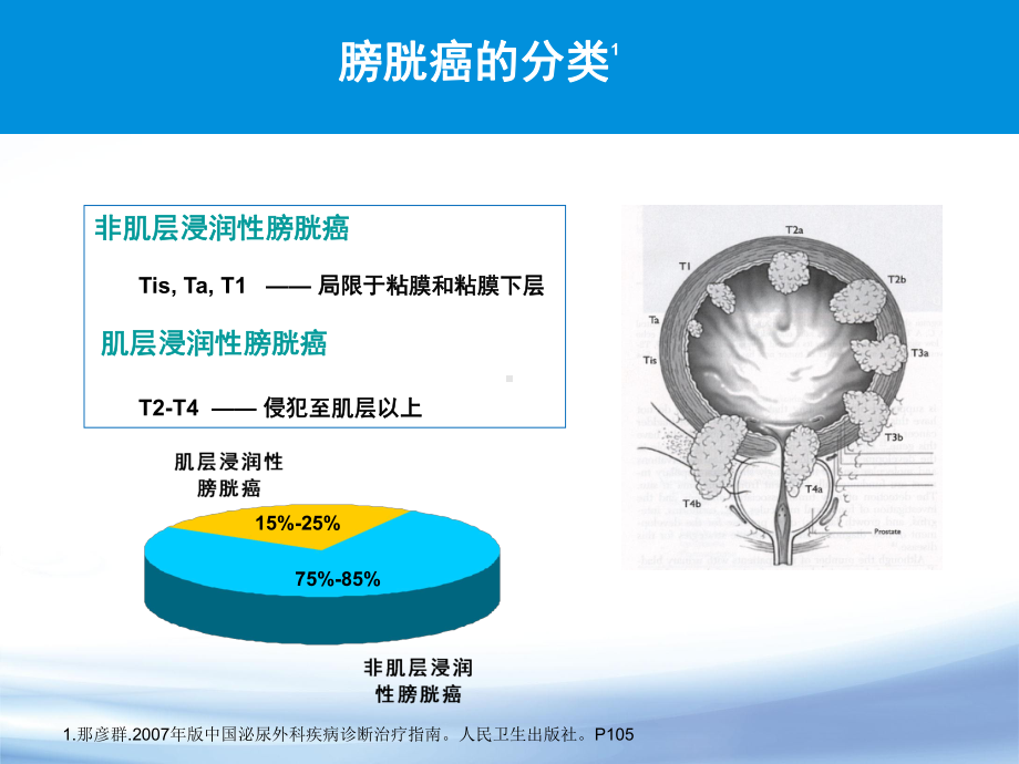 艾达生膀胱科室会课件.pptx_第2页