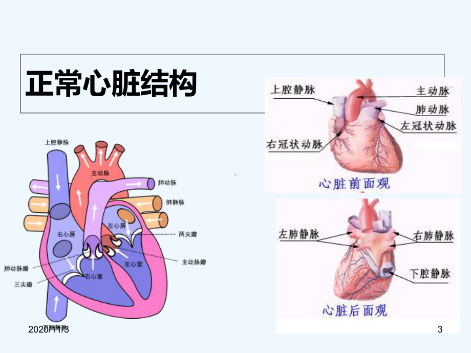 非紫绀型先天性心脏病课件.ppt_第3页