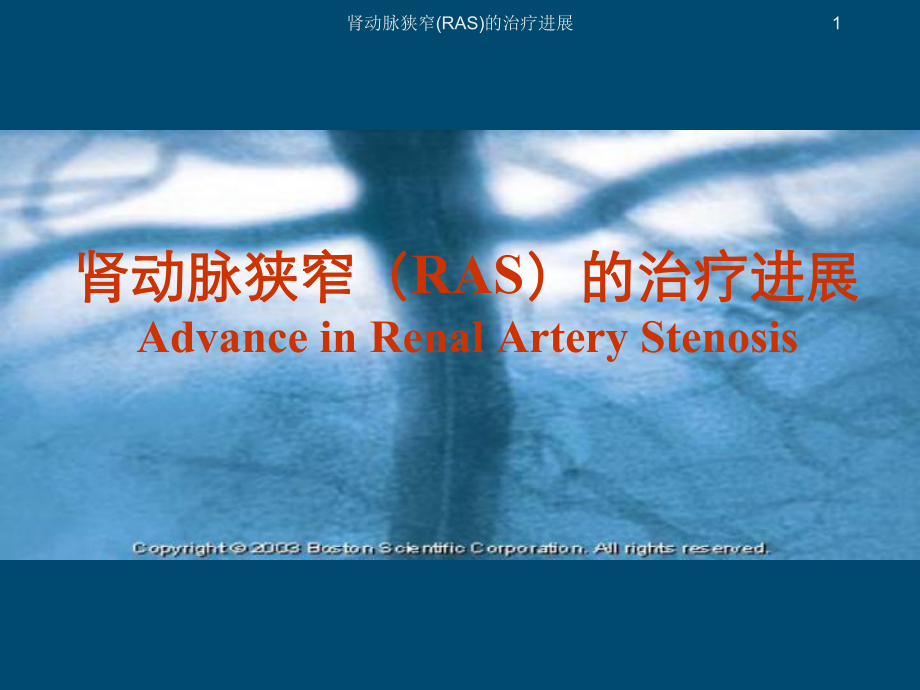 肾动脉狭窄(RAS)的治疗进展课件.ppt_第1页