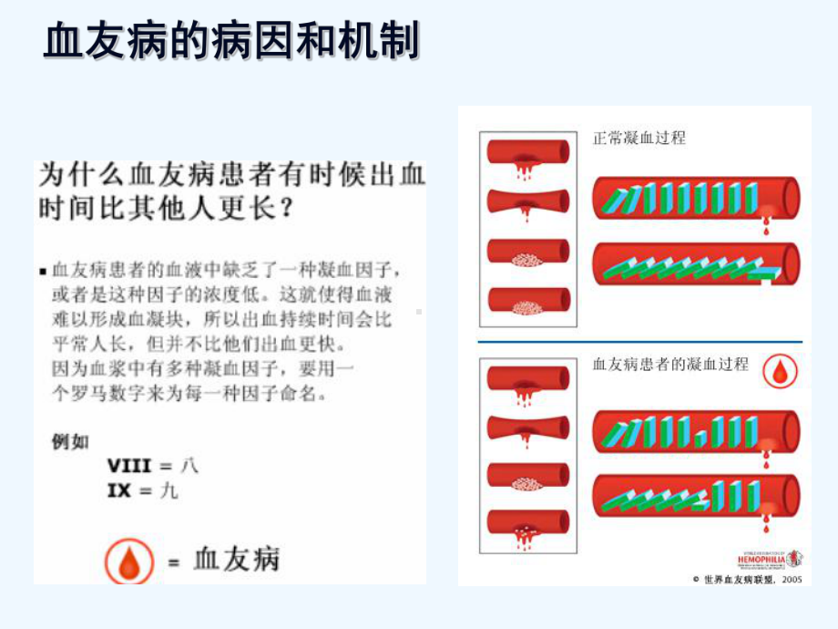 血友病患者科普课件.ppt_第3页