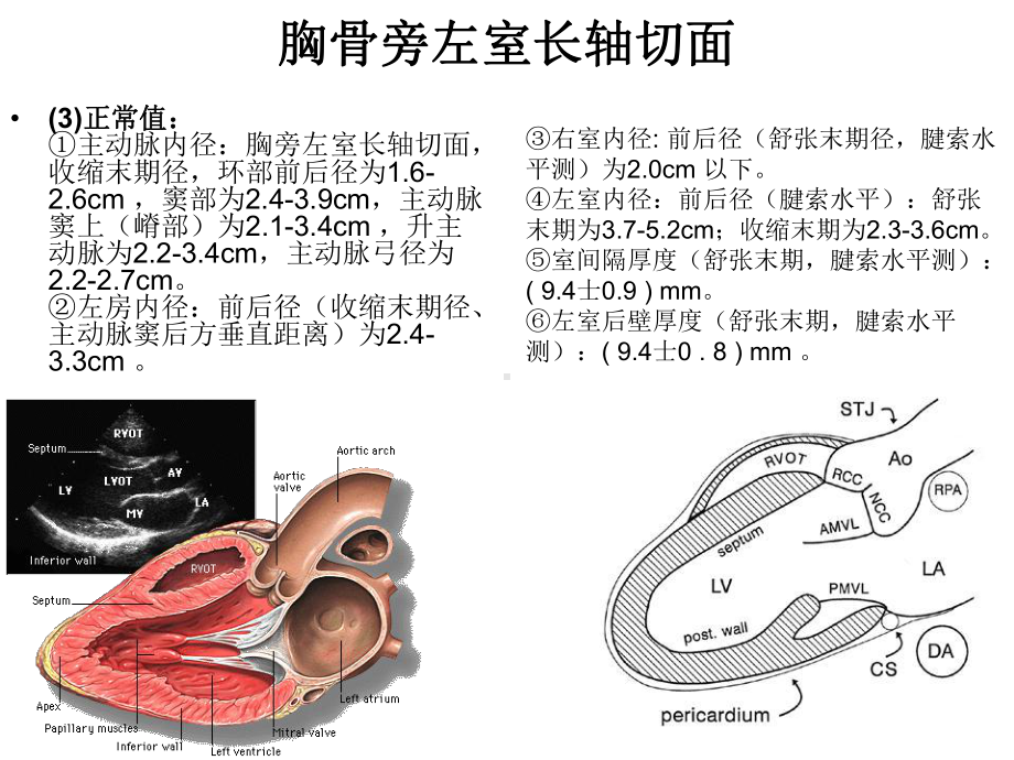 二维超声心动图常用切面及选择课件.ppt_第2页