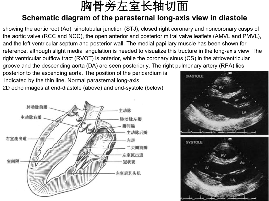 二维超声心动图常用切面及选择课件.ppt_第3页