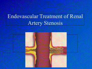 肾动脉支架植入术详解学习课件.ppt