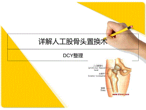 详解人工股骨头置换术课件.ppt