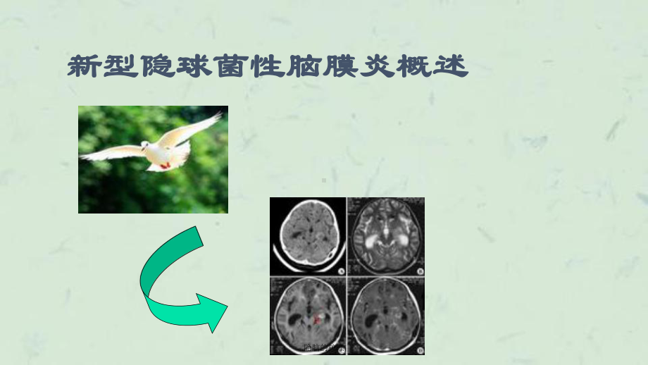 隐脑的护理课件.ppt_第2页