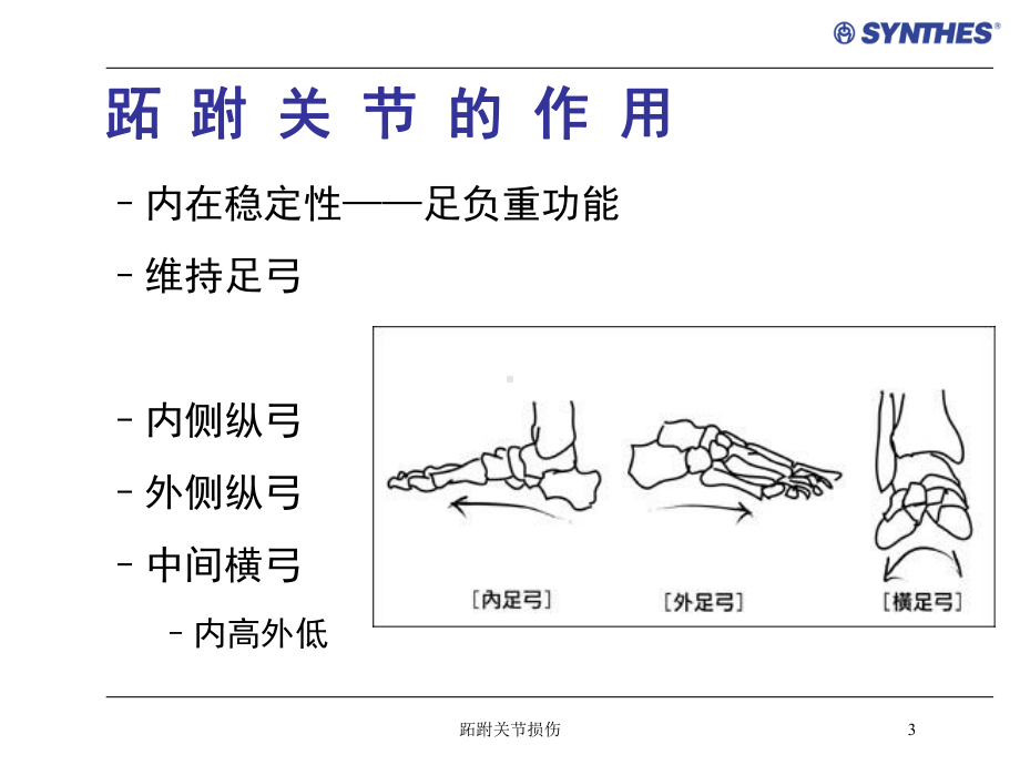 跖跗关节损伤培训课件.ppt_第3页