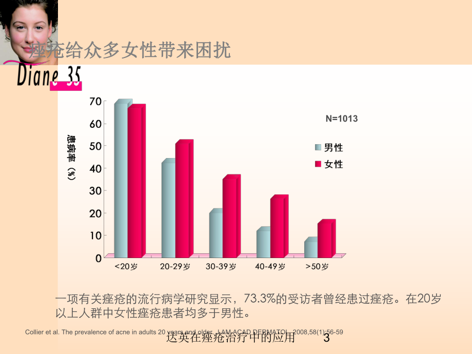 达英在痤疮治疗中的应用培训课件.ppt_第3页