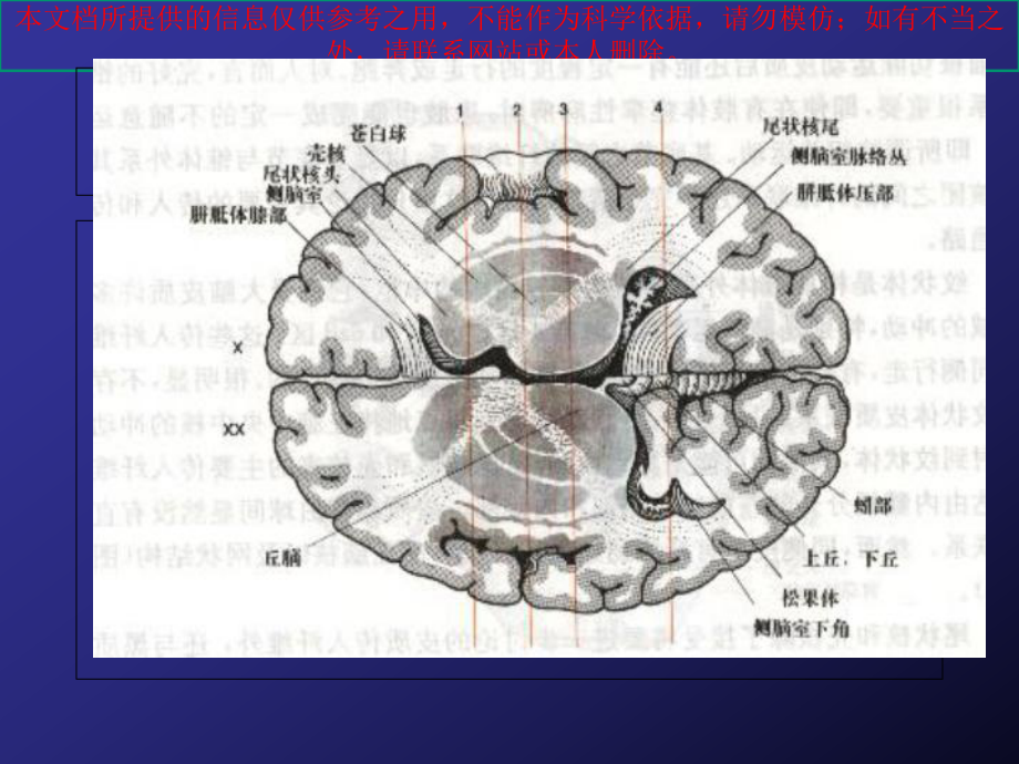 锥体外系疾病概述培训课件.ppt_第3页