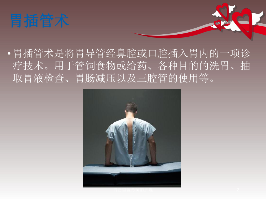 胃管留置鼻饲的护理培训课件.ppt_第2页