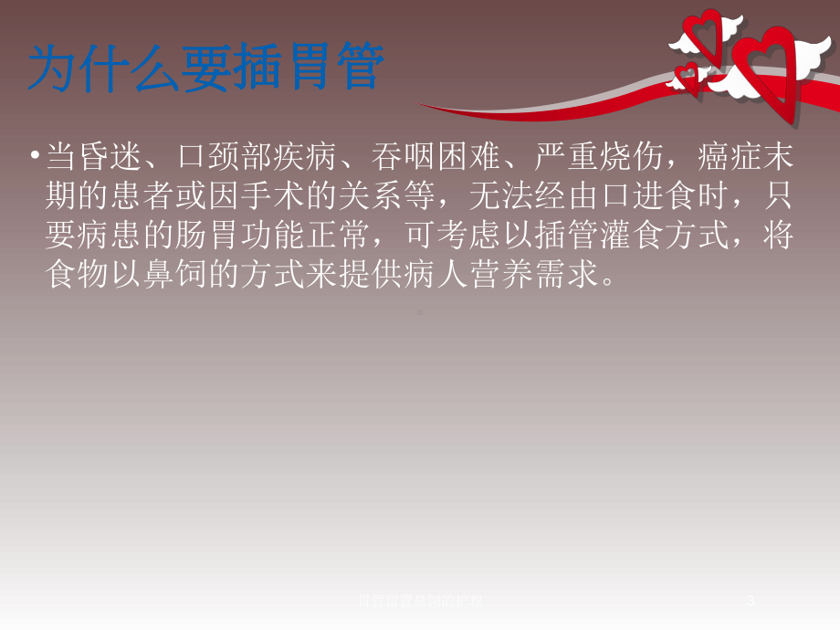 胃管留置鼻饲的护理培训课件.ppt_第3页