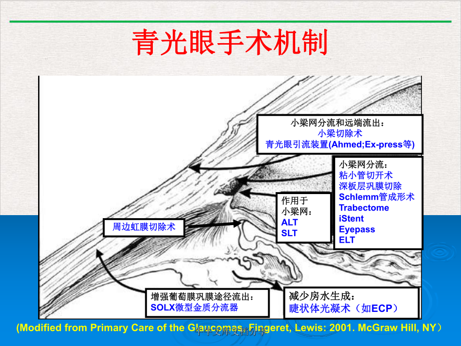 青光眼手术新进展AOGS课件.pptx_第3页