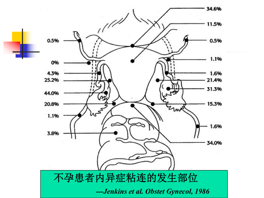 子宫内膜异位症与不育-田秦杰课件.ppt_第3页