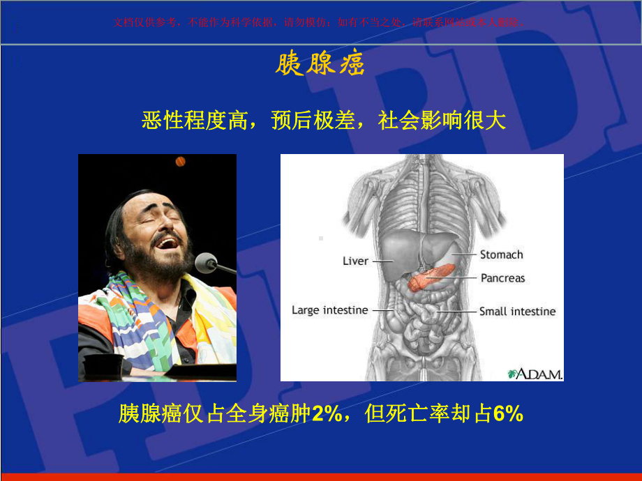 胰腺癌综合治疗的现状和进展培训课件.ppt_第1页