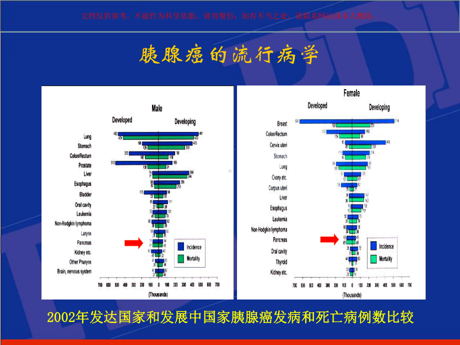 胰腺癌综合治疗的现状和进展培训课件.ppt_第2页