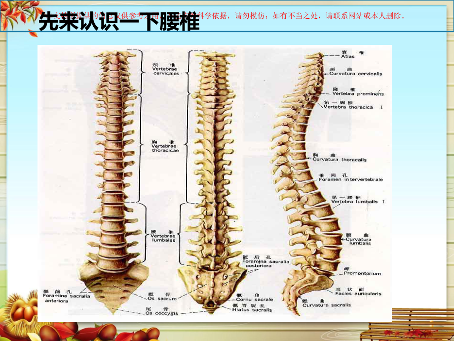 腰椎间盘突出症主题讲座培训课件.ppt_第2页