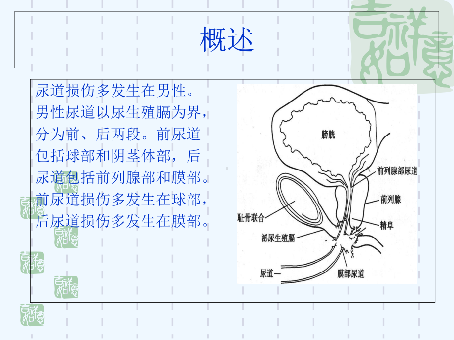 尿道损伤的治疗与护理课件.ppt_第2页