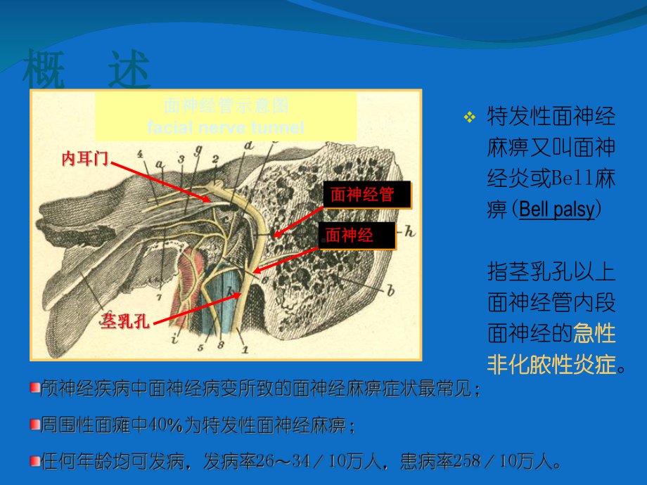 面神经炎的医疗护理培训课件.ppt_第3页