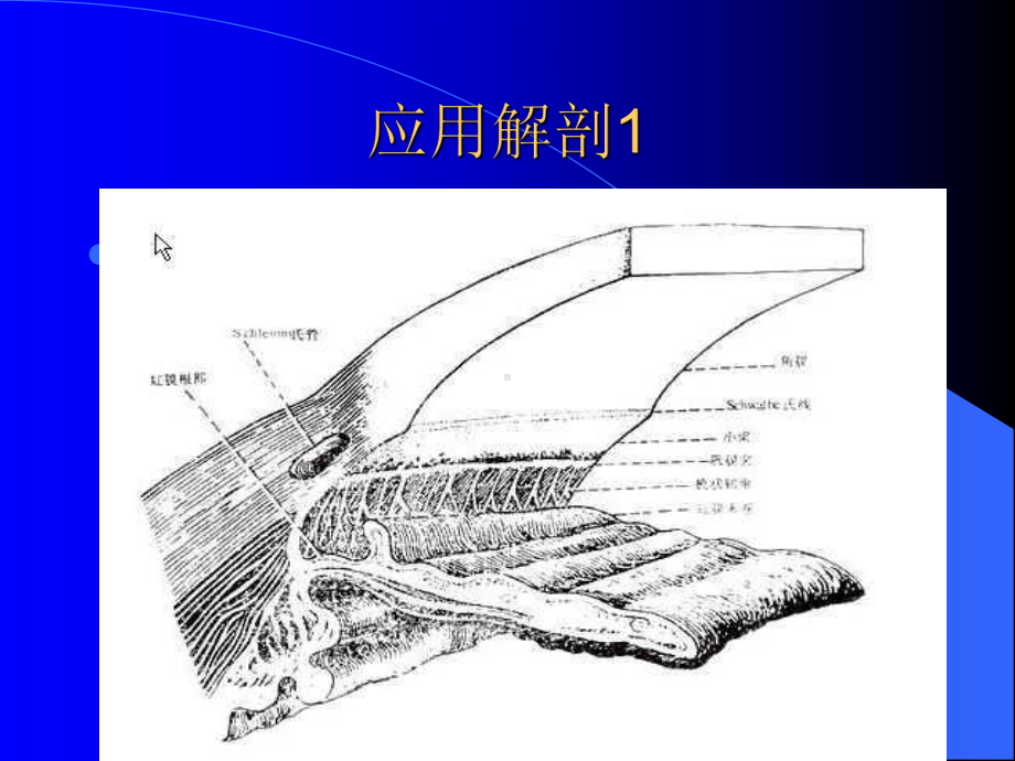 青光眼(Glaucoma)培训课件.ppt_第2页