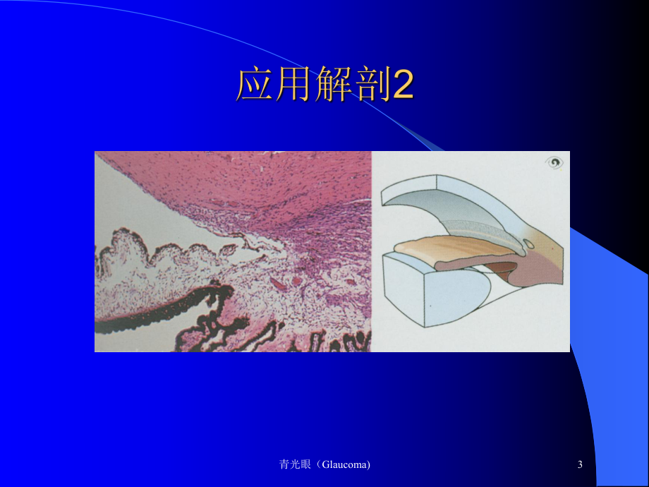 青光眼(Glaucoma)培训课件.ppt_第3页