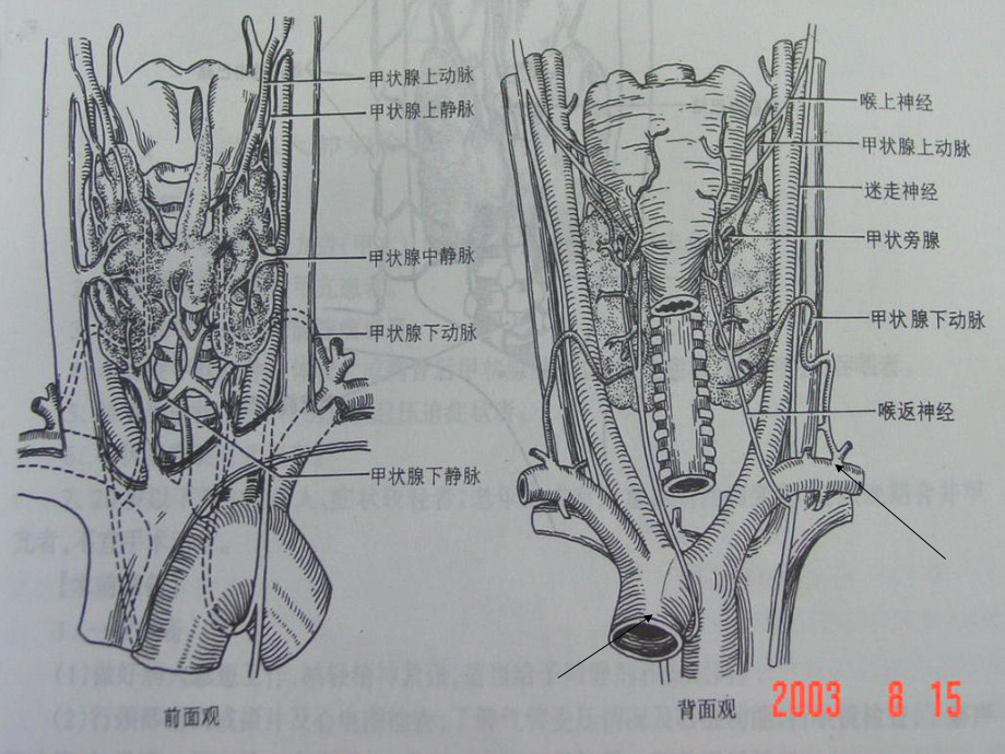 甲状腺的外科教案课件.ppt_第3页