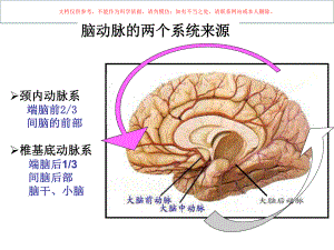 脑血管病影像培训课件.ppt