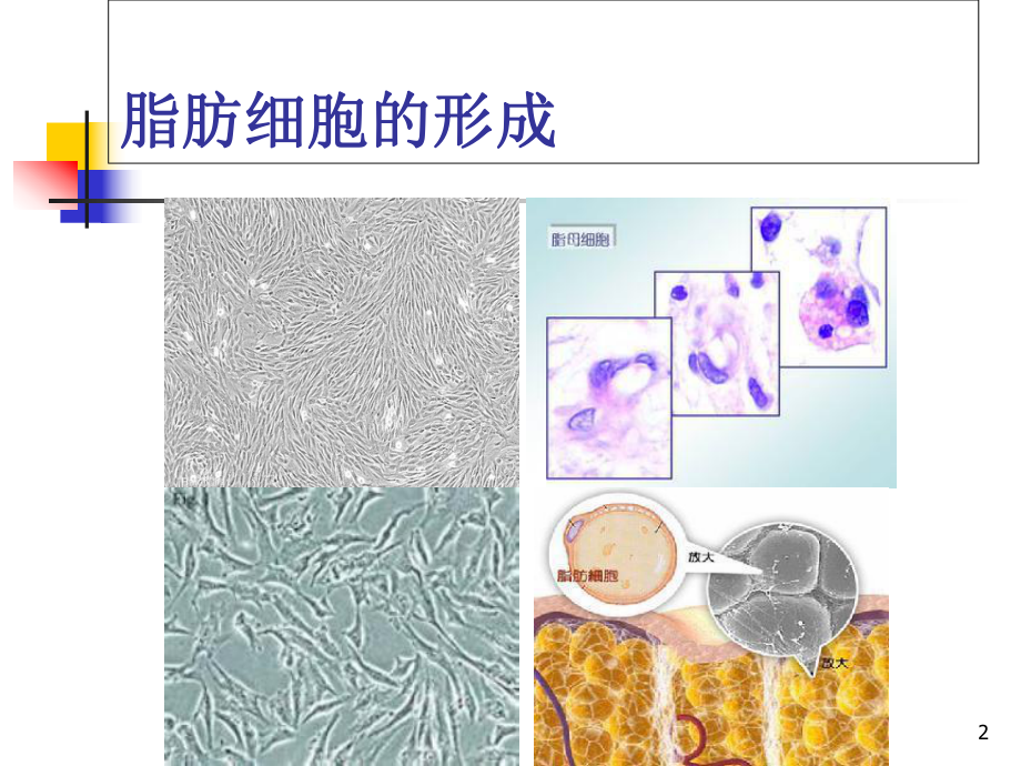 脂肪栓塞综合征学习课件.ppt_第2页