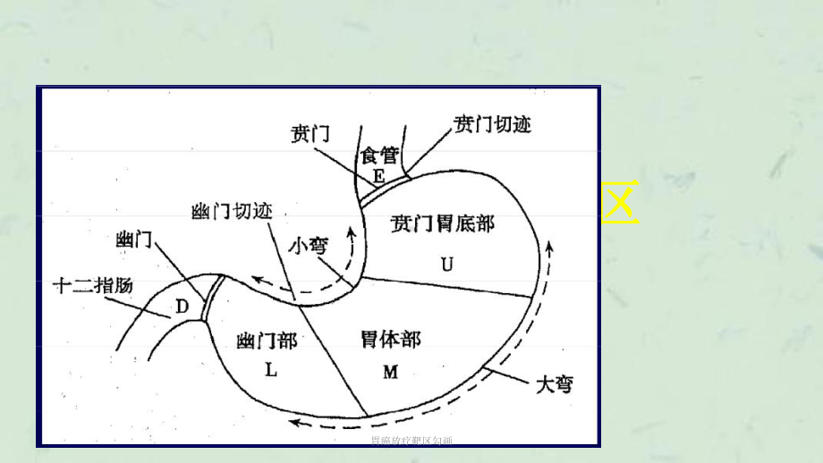 胃癌放疗靶区勾画课件.pptx_第3页